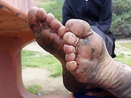 Young homeless 0ff her filthy feet...